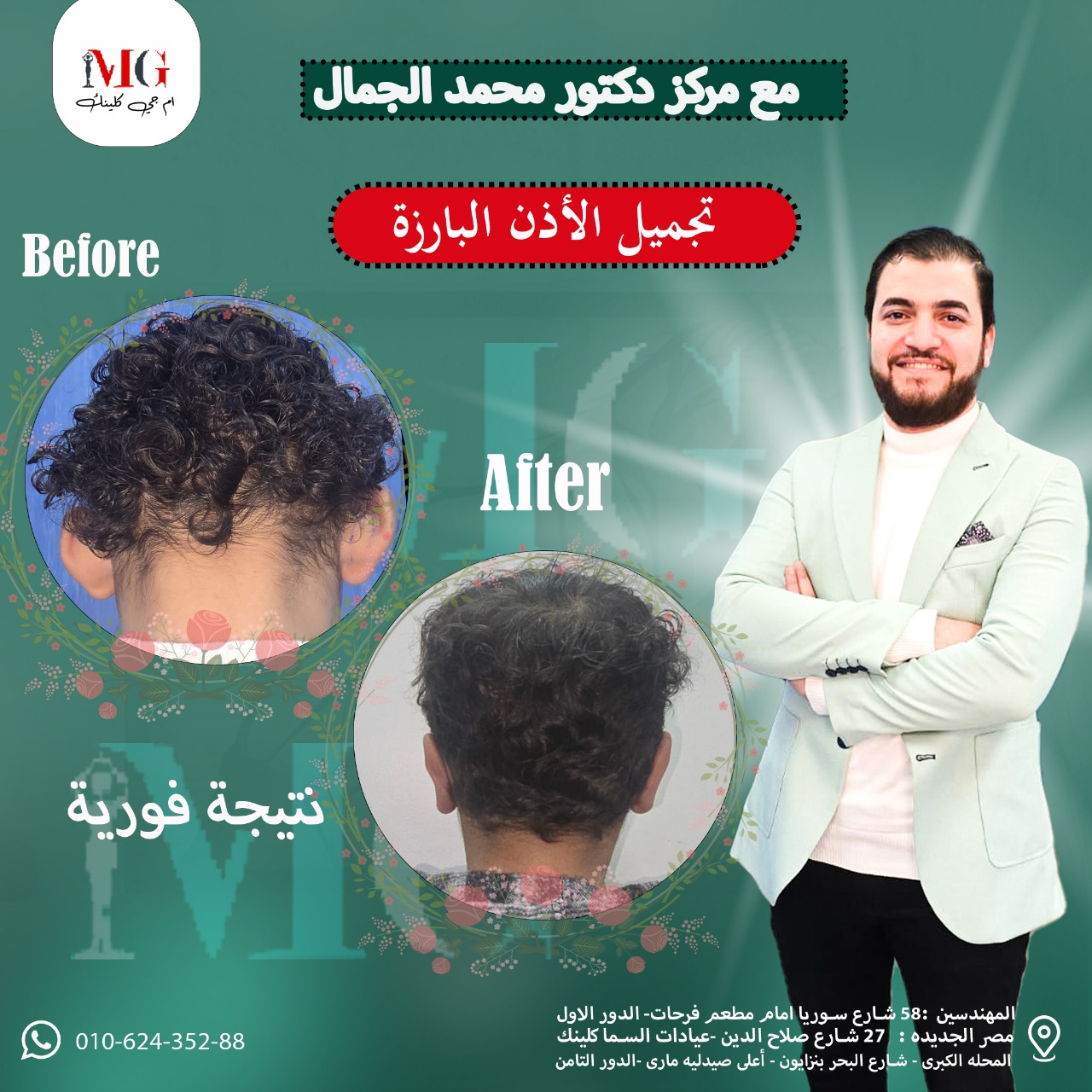تجميل الوجه