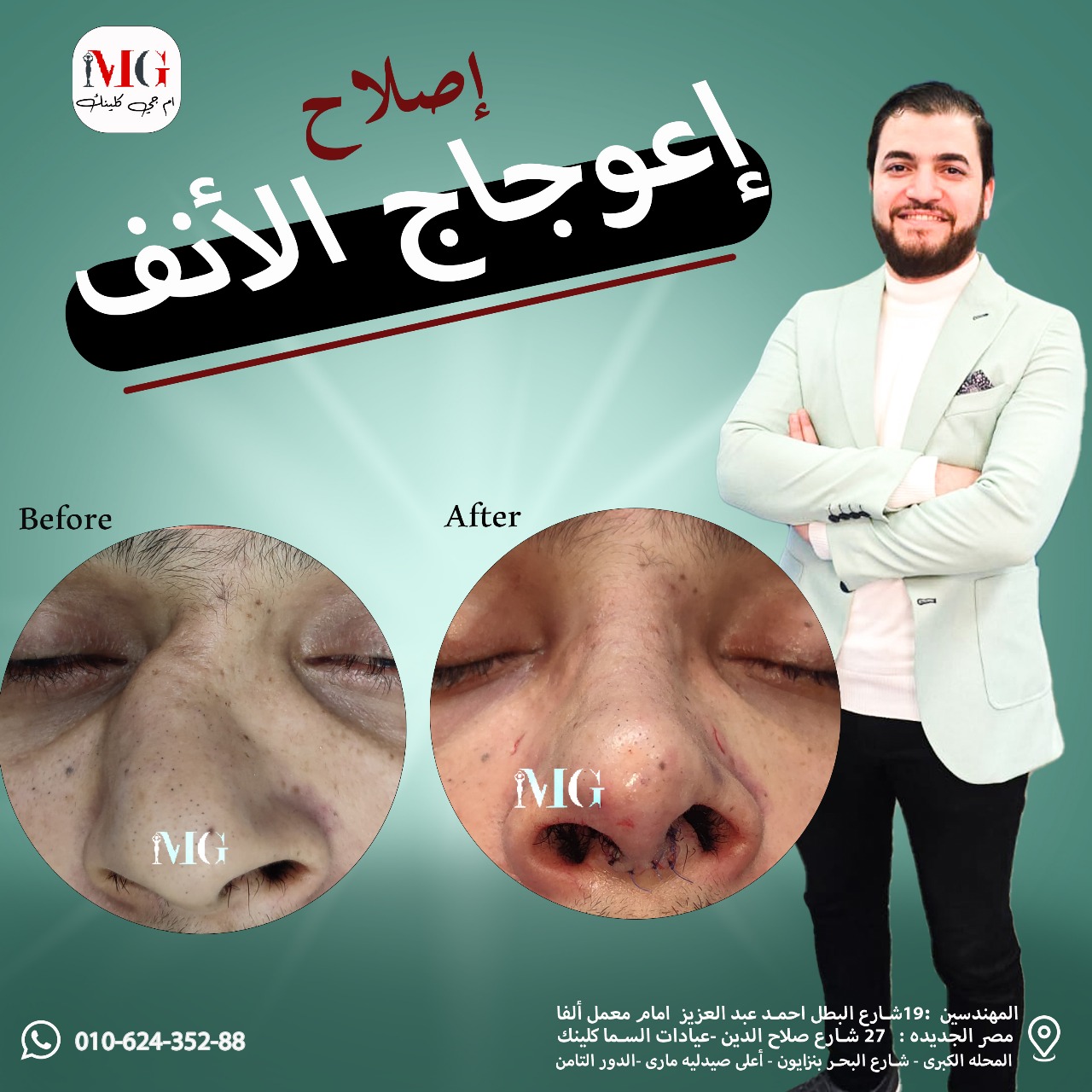 تجميل الوجه