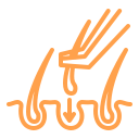 زراعة الشعر